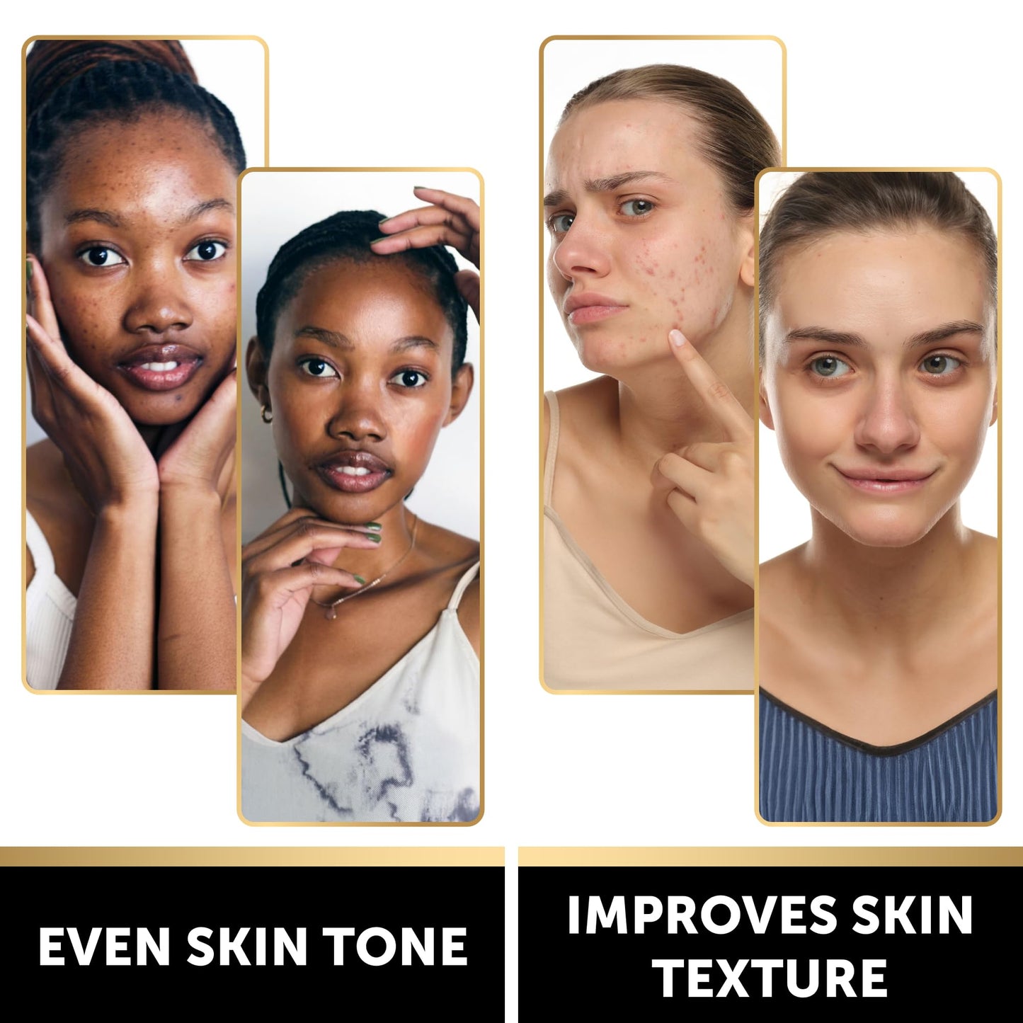 VALITIC Snail Mucin Cleanser Soap Bar with Turmeric and Kojic Acid Dark Spot Corrector – Anti Aging and Purifying Skin Care Snail Secretion for Intense Hydration and Moisturization – 2 Pack