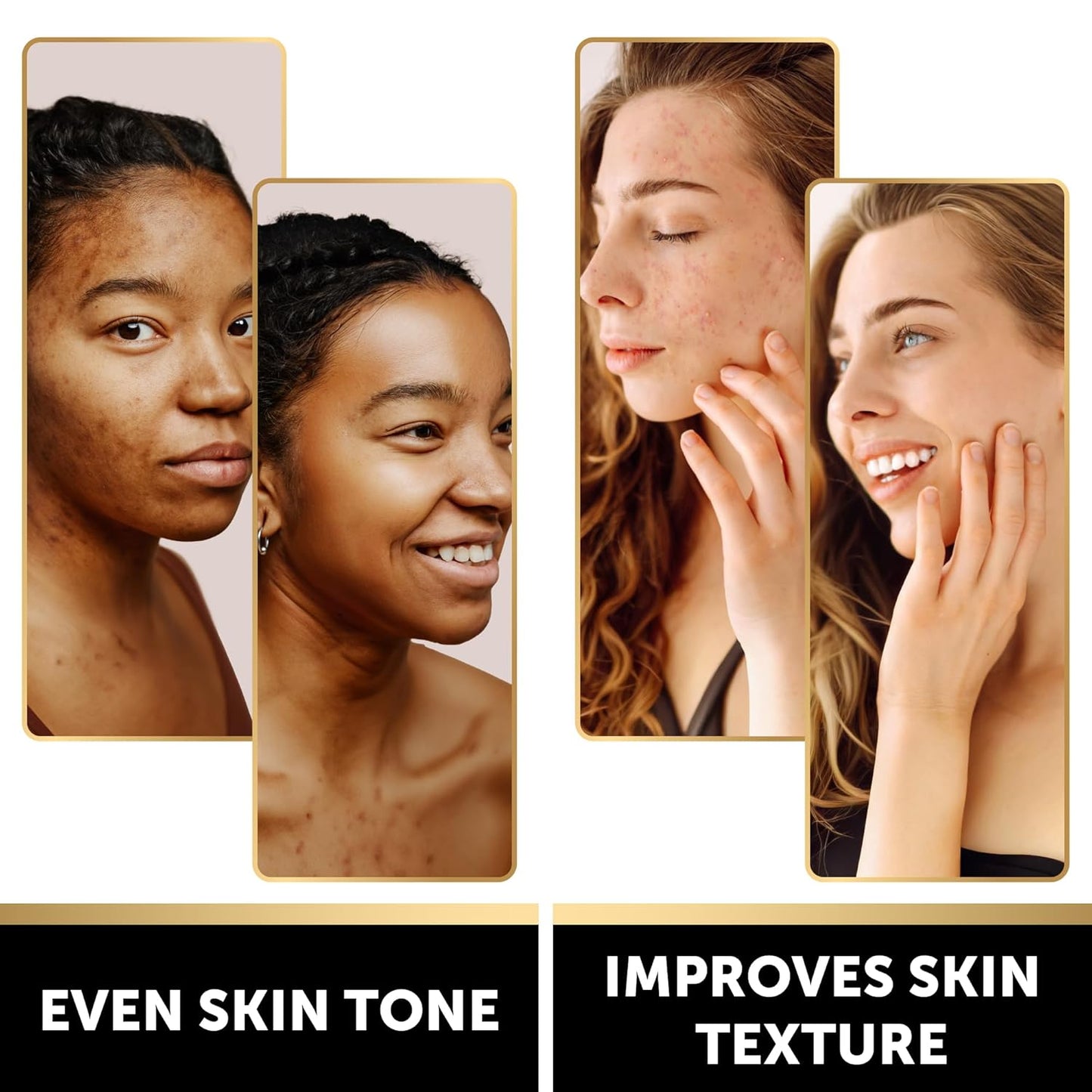 VALITIC Kojic Acid Soap Bars - Turmeric, Snail Mucin, Charcoal and Lemon - Holiday Skin Care Beauty Set Gift 4 Assorted Dark Spot Remover Soaps with Hyaluronic Acid, Vitamin C, Vitamin E, Shea Butter